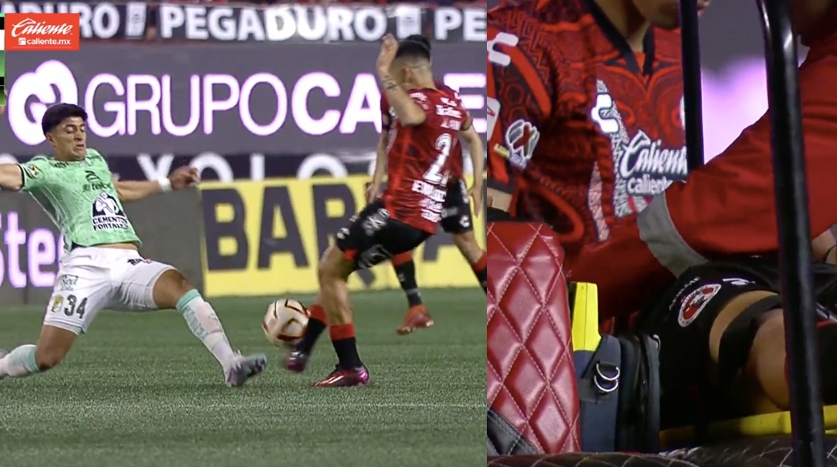 Carlos Valenzuela sufrió una escalofriante lesión en el partido entre Xolos y León.